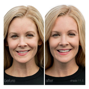 RMS Beauty - UnCoverup Concealer - 5.67 g | 11.5